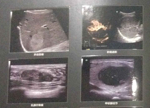 杭州红房子引进比较好的彩超设备 为女性健康严格把关