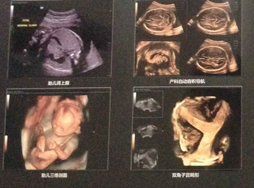 杭州红房子引进比较好的彩超设备 为女性健康严格把关