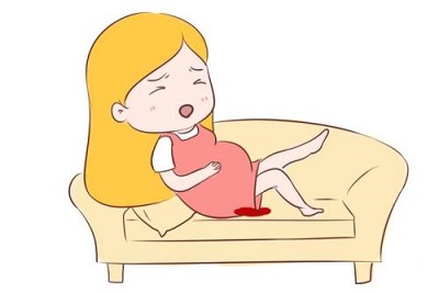 杭州做女性无痛人流要多少钱